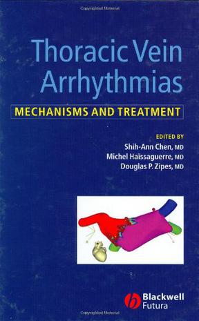 Thoracic Vein Arrhythmias