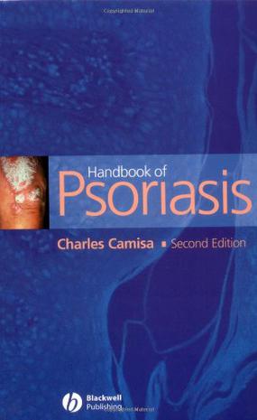 Handbook of Psoriasis