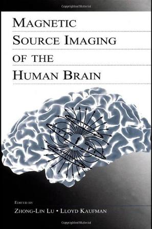 Magnetic Source Imaging Ofthe Human Brain