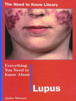Everything Yntka Lupus