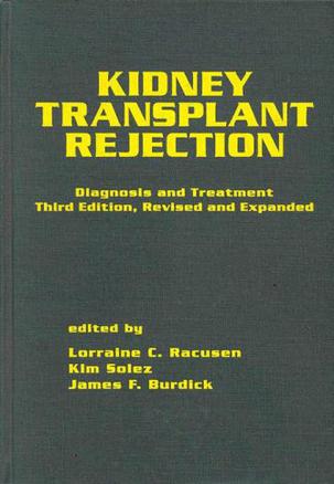 Kidney Transplant Rejection