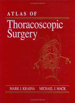 Atlas of Thoracoscopic Surgery