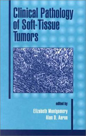 Clinical Pathology of Soft-tissue Tumors
