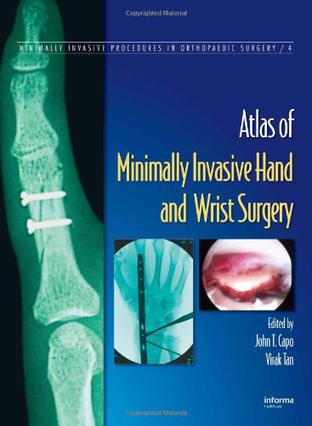 Minimally Invasive Hand and Wrist Surgery