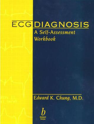 ECG Diagnosis