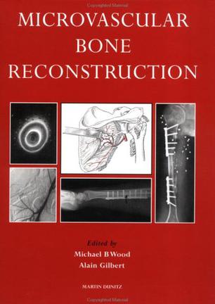Microvascular Bone Reconstruction