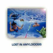 Lost in Amyloidosis