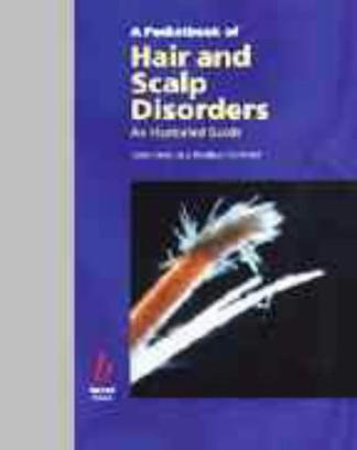 Pocketbook of Hair and Scalp Diseases